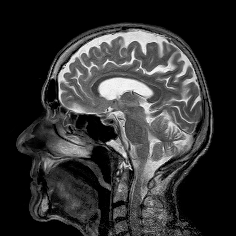 Scan of brain