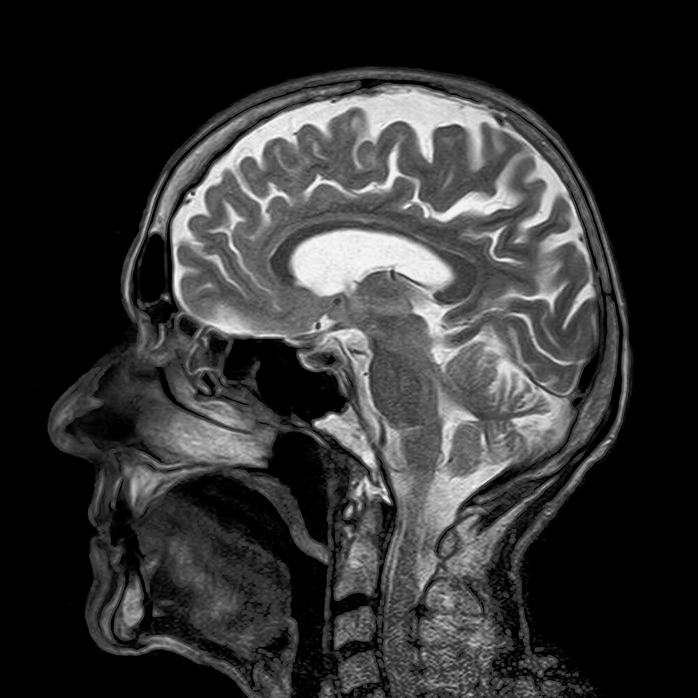 Scan of brain