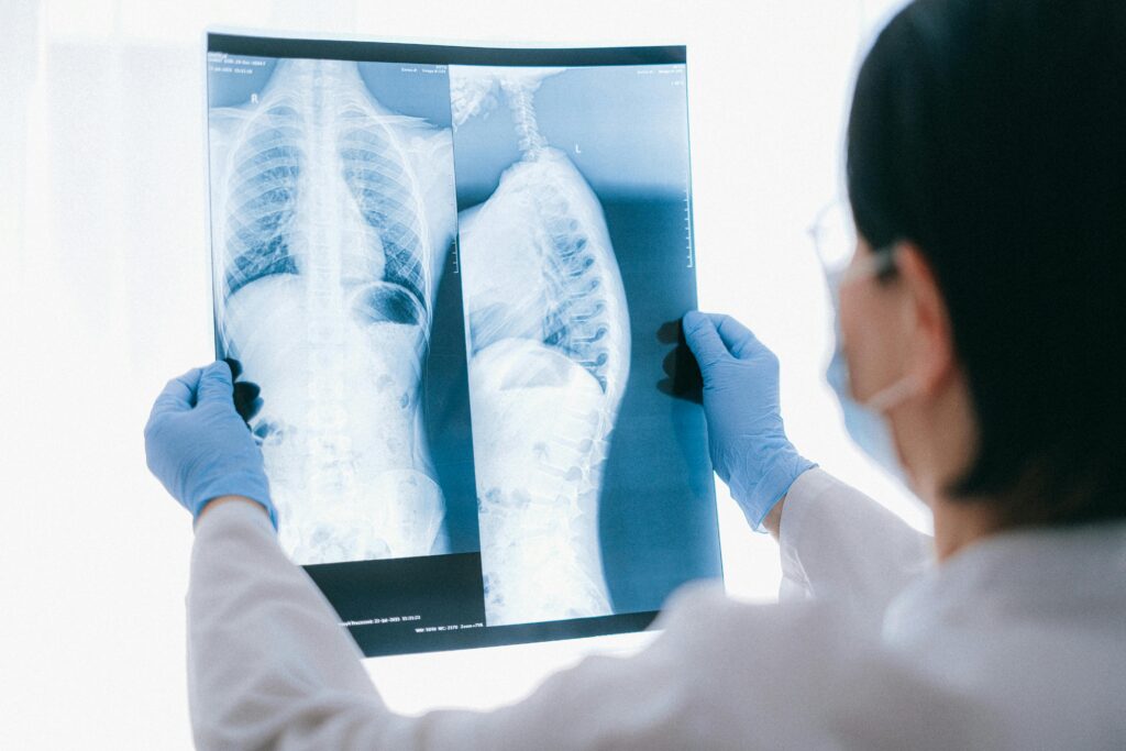 Spinal Cord Injuries in Cleveland