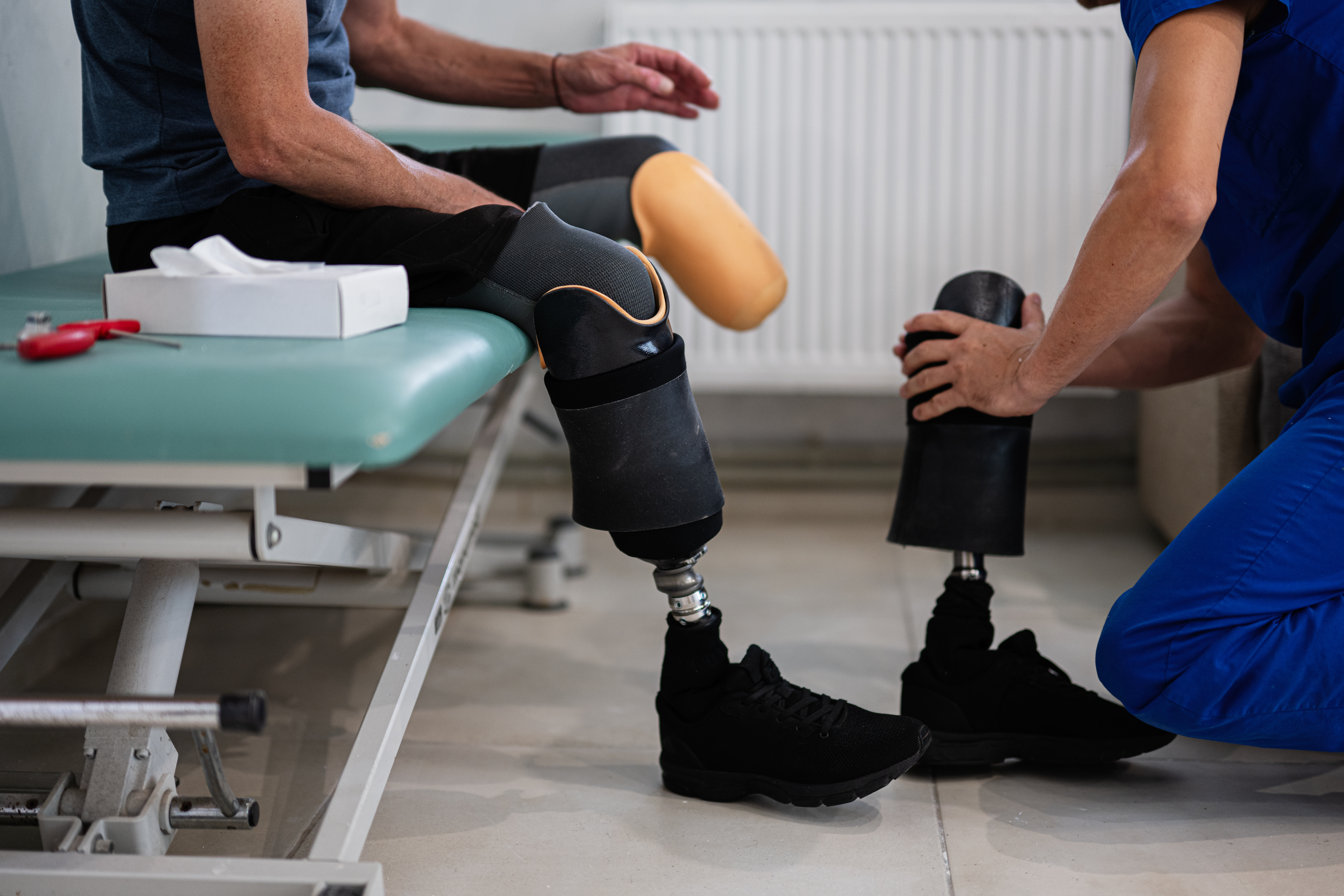 What Are Common Causes of Amputation Injuries?